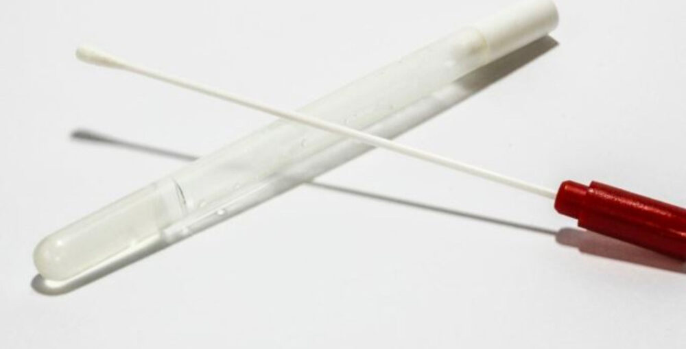 tamponi anali, tampone e provetta